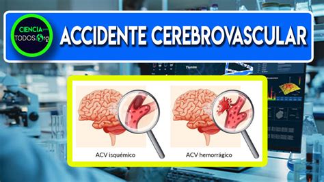 ️¿que Es Un Accidente Cerebrovascular Acv