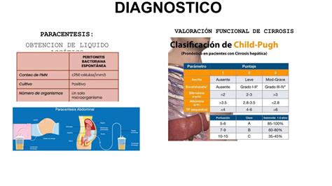 Encefalopatia Hepatica Y Peritonitis Bacteriana Espontanea Pptx