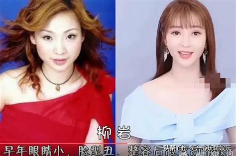 Comparison Of Actress Before And After Plastic Surgery Wang Likun I