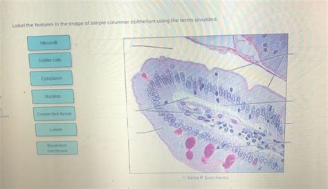 Solved Label The Features In The Image Of Simple Columnar