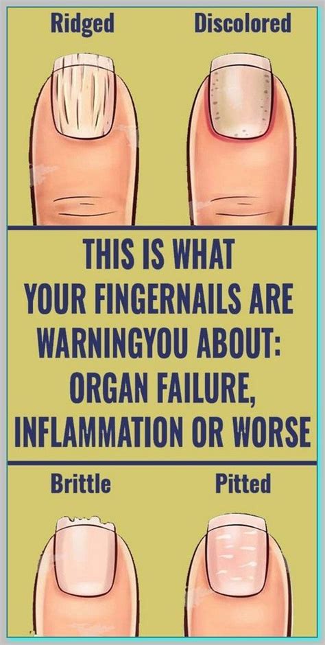 8 Important Signs Your Fingernails Can Tell About Your Health Artofit