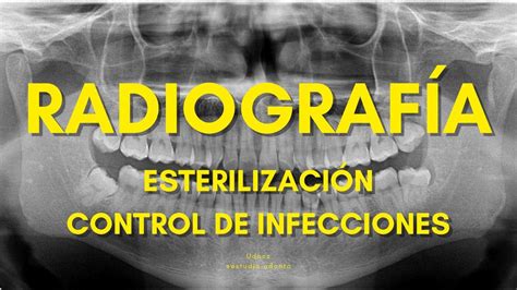 Esterilizaci N En Radiograf As Estudia Odonto Udocz