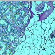 Transverse Section Of The Testicular Tissue For Male Rats Control