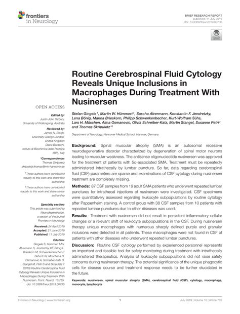 Routine Cerebrospinal Fluid Cytology Reveals Unique Inclusions In Macrophages During Treatment