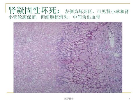 病理学图片库 Ppt课件word文档在线阅读与下载无忧文档