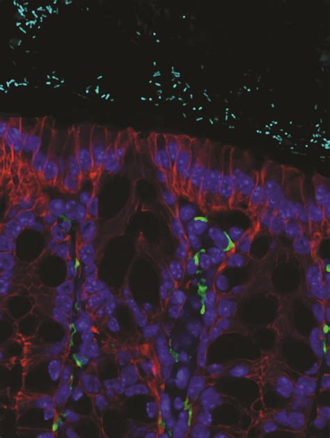 Without a Healthy Immune System, Too Much ‘Good’ Bacteria Can Become a