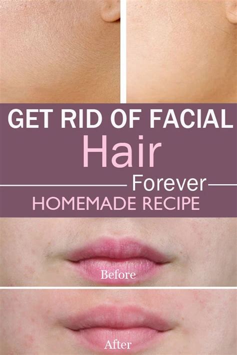 Get Rid Of Facial Hair Forever Healthylife