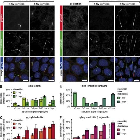 Elongation Of Short Primary Cilia Induces Their Glycylation A Download Scientific Diagram