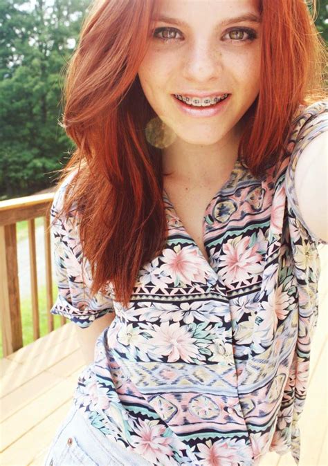 Girls With Braces On Twitter Lovely Red Hair Braces