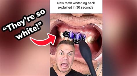 Magic Purple Whitening Toothpaste Orthodontist Reacts Youtube