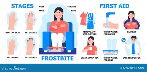 Frostbite First Aid Info Graphic Vector Girl Is Warming Hand In Water