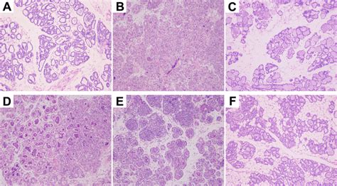 Histopathology Of Mammary Gland Tissues A Mammary Gland Tissue Of