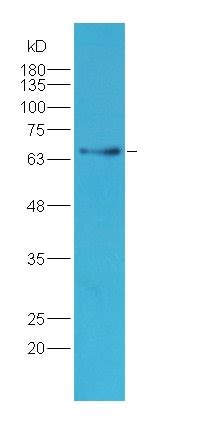 Prolactin Receptor PRL R抗体 Abcam中文官网