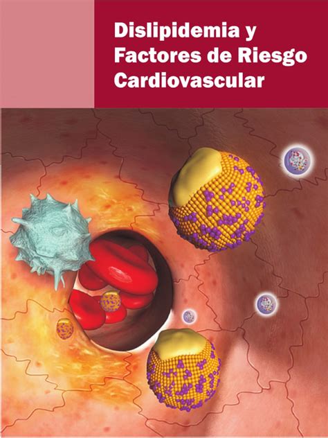 Pdf Dislipidemia Y Factores De Riesgo Pdf Pdfslide Net