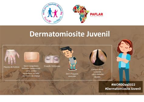 Dermatomiosite Juvenil - PAFLAR