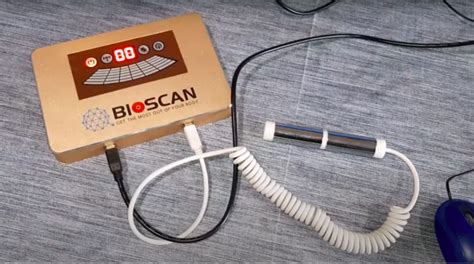 Duitse uitvinder bioresonantieapparaat Bioscan krijgt gevangenisstraf