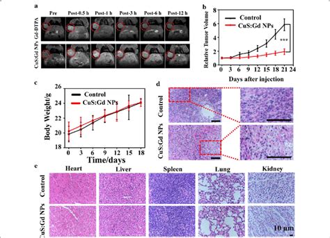 In Vivo Mri Performance And Cdt Ability Of Cusgd Nps A T 1 Weighted