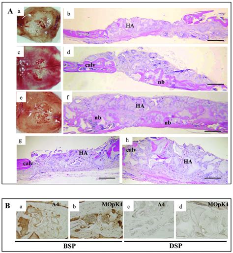 Bone Formation Months After Implantation Of Progenitors In