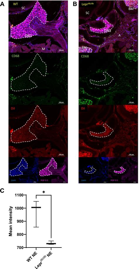 Identification CD68 And DiI Cells Within The Thighs Of WT And