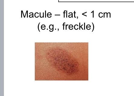 Health Assessment Week Assessing The Integumentary System Wounds