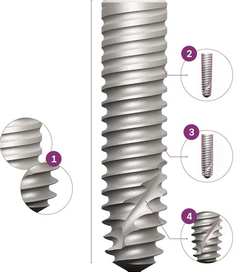 Helix Gm Narrow Neodent Dental Implant System