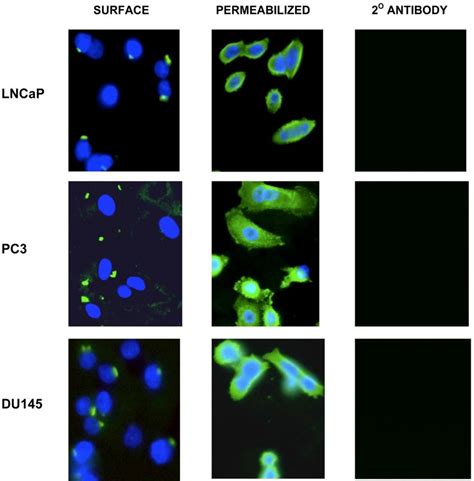 Vimentin Is Detected On The Surface Of Du145 Lncap And Pc3 Tumor Cells