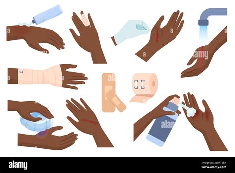 First Aid For Hand Injury Vector Set Vector Illustration Injured Dark