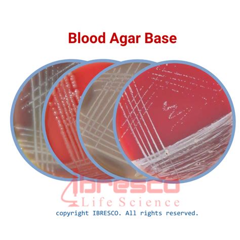 Blood Agar Base بلاد آگار بیس ibresco