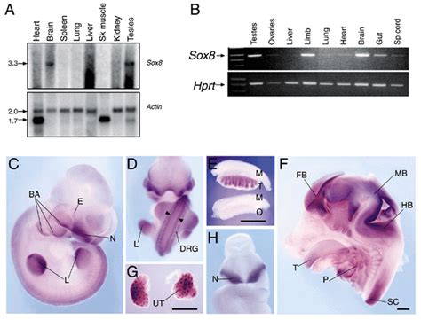 Expression Of Murine Sox8 A Northern Blot Showing Expression In