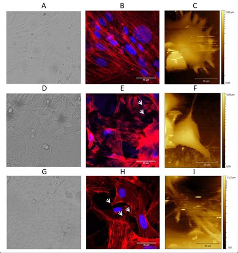 Representative Images Of Cells In Confocal Microscopy Actin