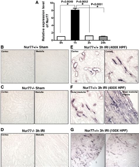 Expression Pattern Of Nur In The Tubular Epithelial Cells During