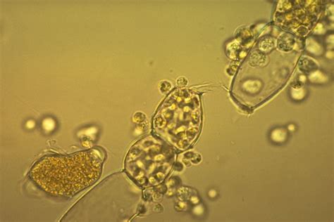 Botany 201 Laboratory Chytridiomycota