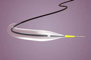 PTCA Catheter MISTRAL 2 NC Hexacath Coronary Balloon