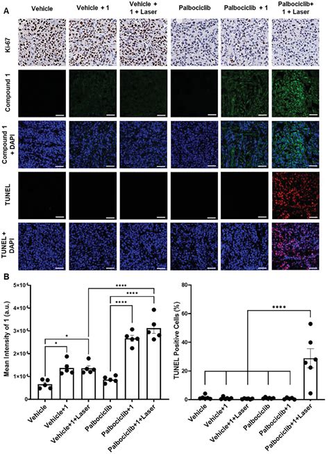 βGalactosidaseTriggered Photodynamic Elimination of Senescent Cells