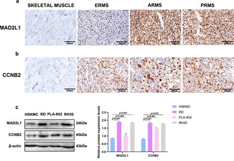 Expression Of MAD2L1 And CCNB2 In RMS Tissues And Cells A IHC Analysis