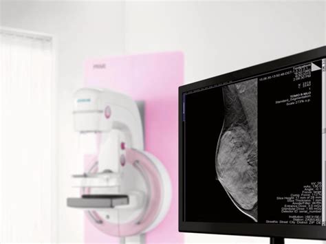 Mammomat Inspiration Digital Mammography Machine Siemens Healthineers