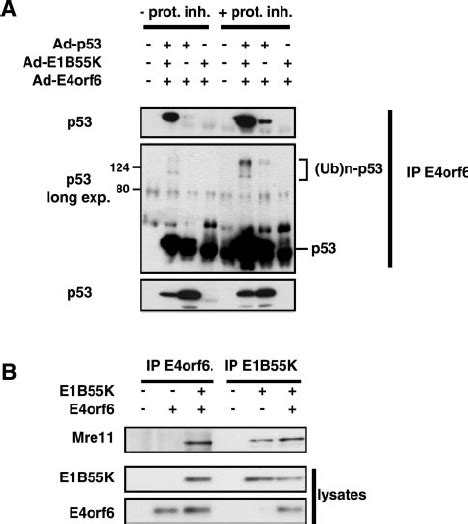 Role Of E1B55K In The Binding And Ubiquitination Of P53 And The Binding