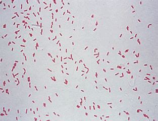 pseudomonas alchetron   social encyclopedia