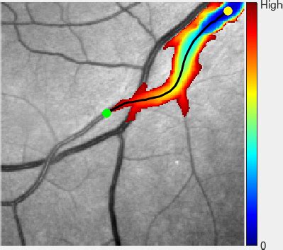 A The Geodesic Distance Map Us Superimposed On The Retinal Patch The