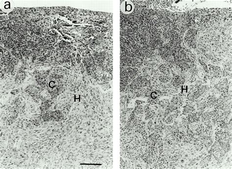 Invasive Behavior Of Malignant Mouse Keratinocytes Pdva Cells 2 Wk