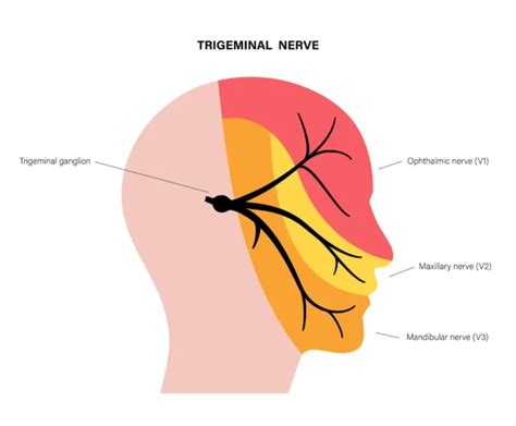 Trigeminal Neuralgia Causes Symptoms And Treatments