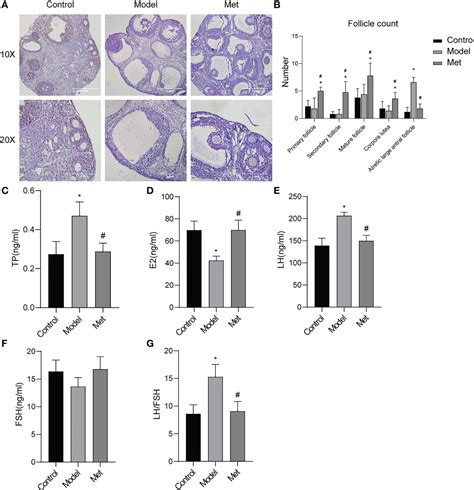 Frontiers Metformin Improves Polycystic Ovary Syndrome In Mice By