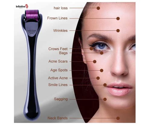 New Titanium Microneedle 540 Needle Roller Acne Skin Hair Loss Wrinkles Derma Mm Ebay