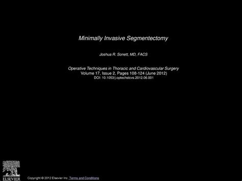 Minimally Invasive Segmentectomy - ppt download