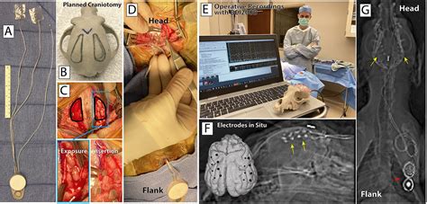 Frontiers Toward A Fully Implantable Ecosystem For Adaptive