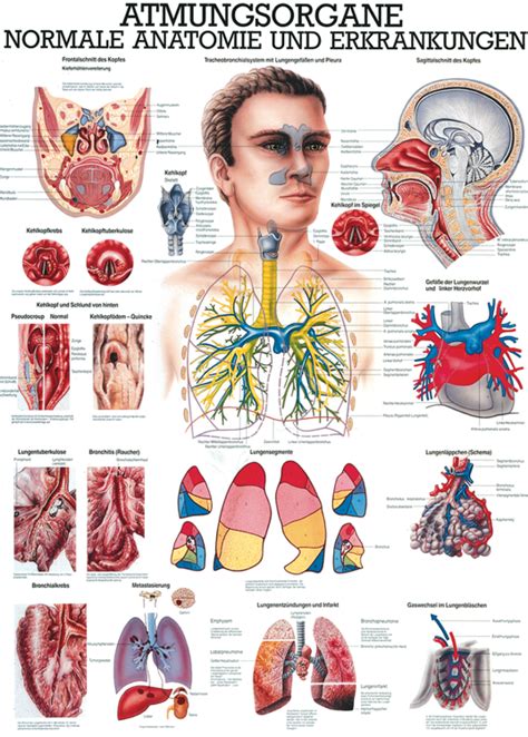 Understanding Diabetes Anatomical Chart Artofit