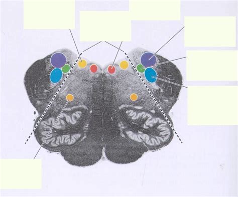 Brain stem Diagram | Quizlet