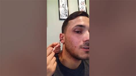 Bjj Cauliflower Ear Drain Youtube