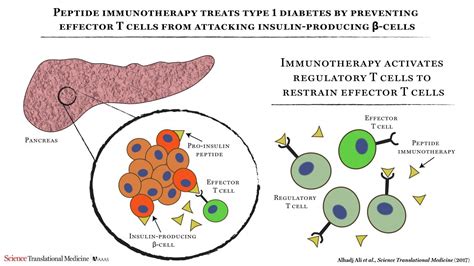 Immunotherapy Safe For Diabetes 1 2017 Wiley Analytical Science