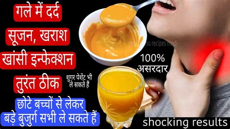 गले में सूजन खासी खराश Infection तुरंत ठीक करने के 2 रामबाण तरीके Throat Infection Home